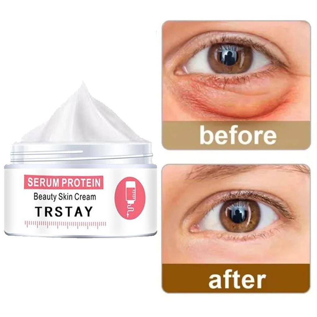 Moisturizing Eye Cream To Brighten Skin Tone, Moisturize, Lighten Dullness, and Firm Skin