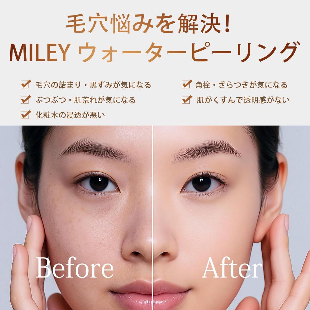 [Water Peeling] Ultrasonic Peeling Cleanser with EMS Ion Introduction/Extraction Function, Red/Blue/Orange Light Therapy, Pore Care, Exfoliation, Blac