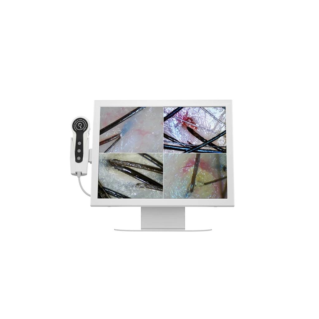 HD Digital Skin Analyzer Professional Hair Scalp Camera Detector Hair Follicle Oil Moisture Test Device 15inch