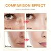 Moisturizing and Moisturizing Cream with Cream Texture Improves Skin Condition, Uniforms Skin Color, Nourishes Skin Care Cream