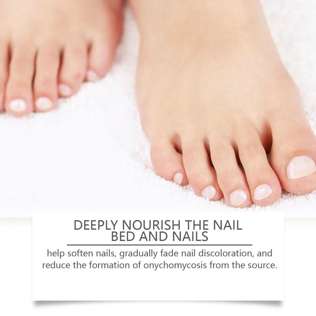 Nourishing Wiyun Nail Care Cream For Gentle Restoration And Shine Enhancing Treatment