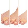 1 pair Nude Toes Separator Gel Material Hammer Toe Straightener Toe Corrector  Claw Toes