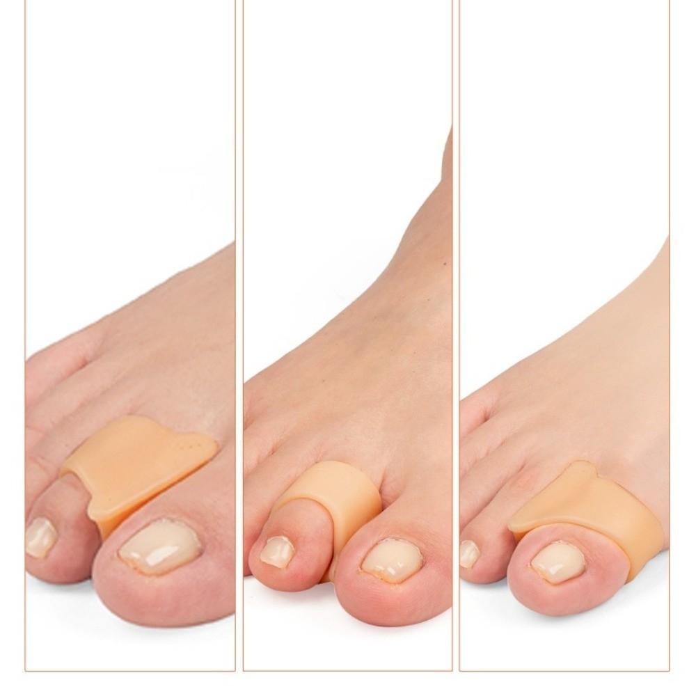 1 pair Nude Toes Separator Gel Material Hammer Toe Straightener Toe Corrector  Claw Toes