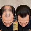 Hair Care Hair Growth for Man Women Products Fast Growing Hair Oil Hairloss Care Liquid Beauty Protect