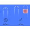 5 Types Foreskin Correction Cock Ring Penis Sleeve Delay Ejaculation Male Chastity Cage Sex Toys For Men Sex Products Sex Shop