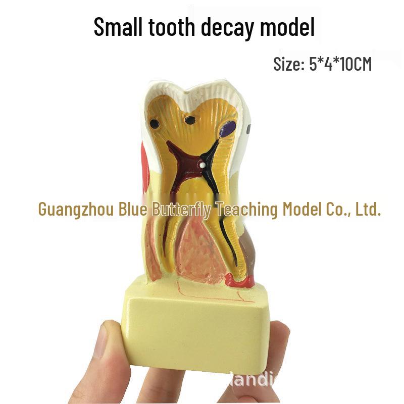 Large Kindergarten Oral Health Toothbrushing Model for Early Education