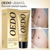 OEDO Rose Pregnancy Cream - Repairs Stretch Marks & Improves Elasticity