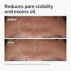 10% Niacinamide 1% Zinc Face Serum 30ml, Oil Control Pore Minimizer, Anti-Acne Dark Spot, Gentle Skin Care for All Skin Types less