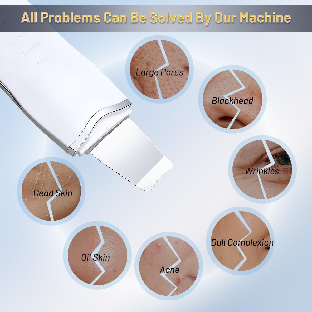 Ultrasonic Skin Scrubber Ance Pore Cleaner Peeling Blackhead Remover Deep Face Cleaning Ultrasonic Ion Facial Shovel Cleanser