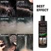 100ml Scalp Ringworm Anti-itch Shampoo Dandruff Control Oil Anti-itch Shampoo Anti-loss Oil Control Refreshing Shampoo