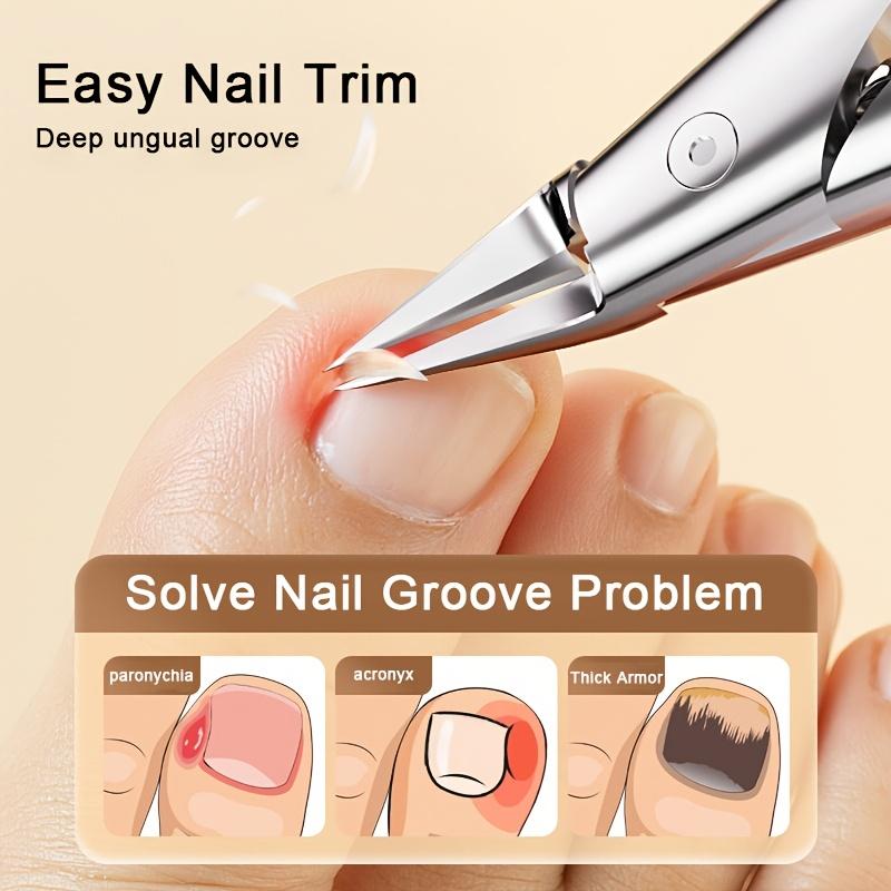 1pcs Nail Clippers Toenail Cutters Pedicure Manicure Tools Non-Splash Ingrown Paronychia Professional Correction Tool Sets