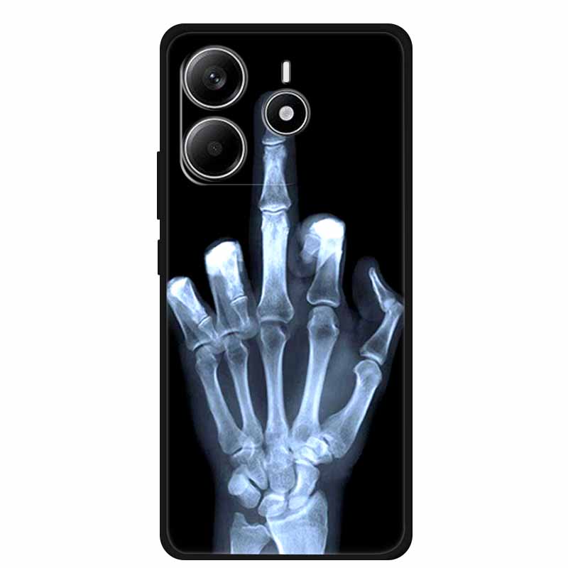 Pour Redmi Note 14 4G GLOBAL Coque Animaux Silicone Souple TPU Étuis de Téléphone Housse Arrière pour Xiaomi Redmi Note14 4G Protecteur Coque