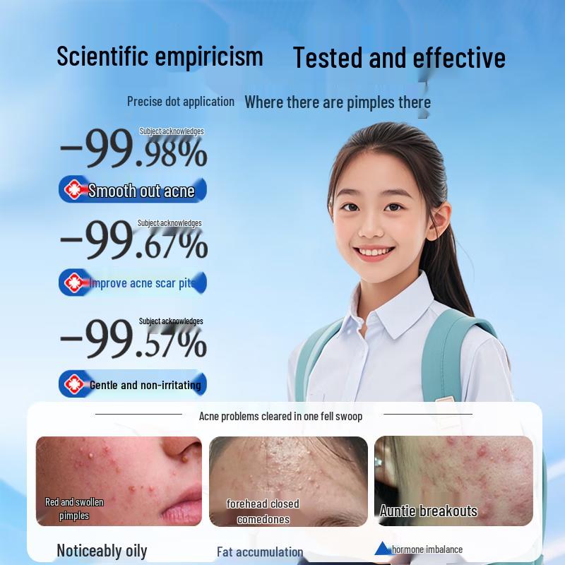 BEAUTY NOTES Teen Skincare for Acne & Blemishes