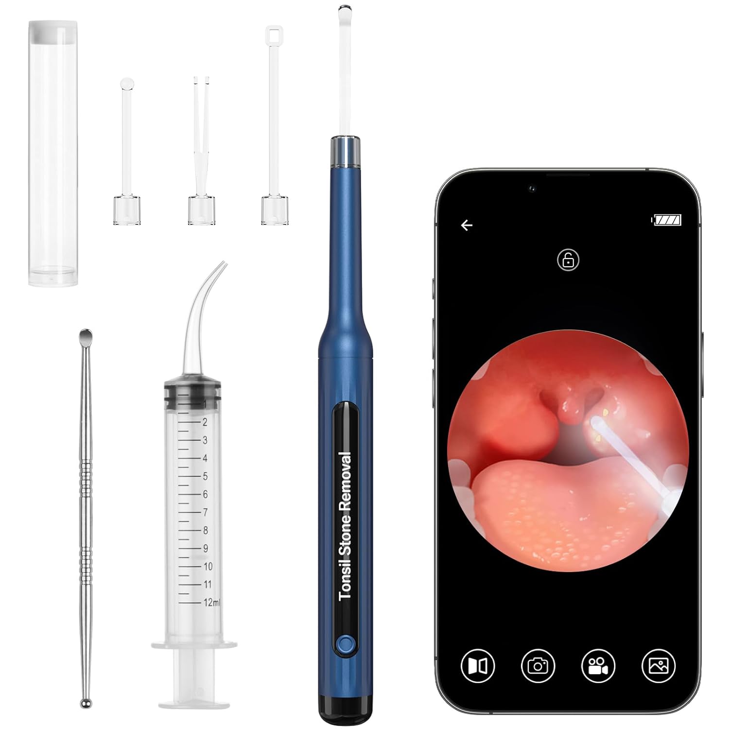 

Удаление камней из миндалин с камерой - Набор для удаления камней из миндалин 2025 года со светодиодной подсветкой Инструмент для удаления тонзиллолитов Очиститель миндалин с 4 насадками, Камень миндалины