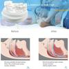 Goodbuy 1 PCS Adjustable Braces (PC+EVA) - Reduce Teeth Grinding and Improve Sleep