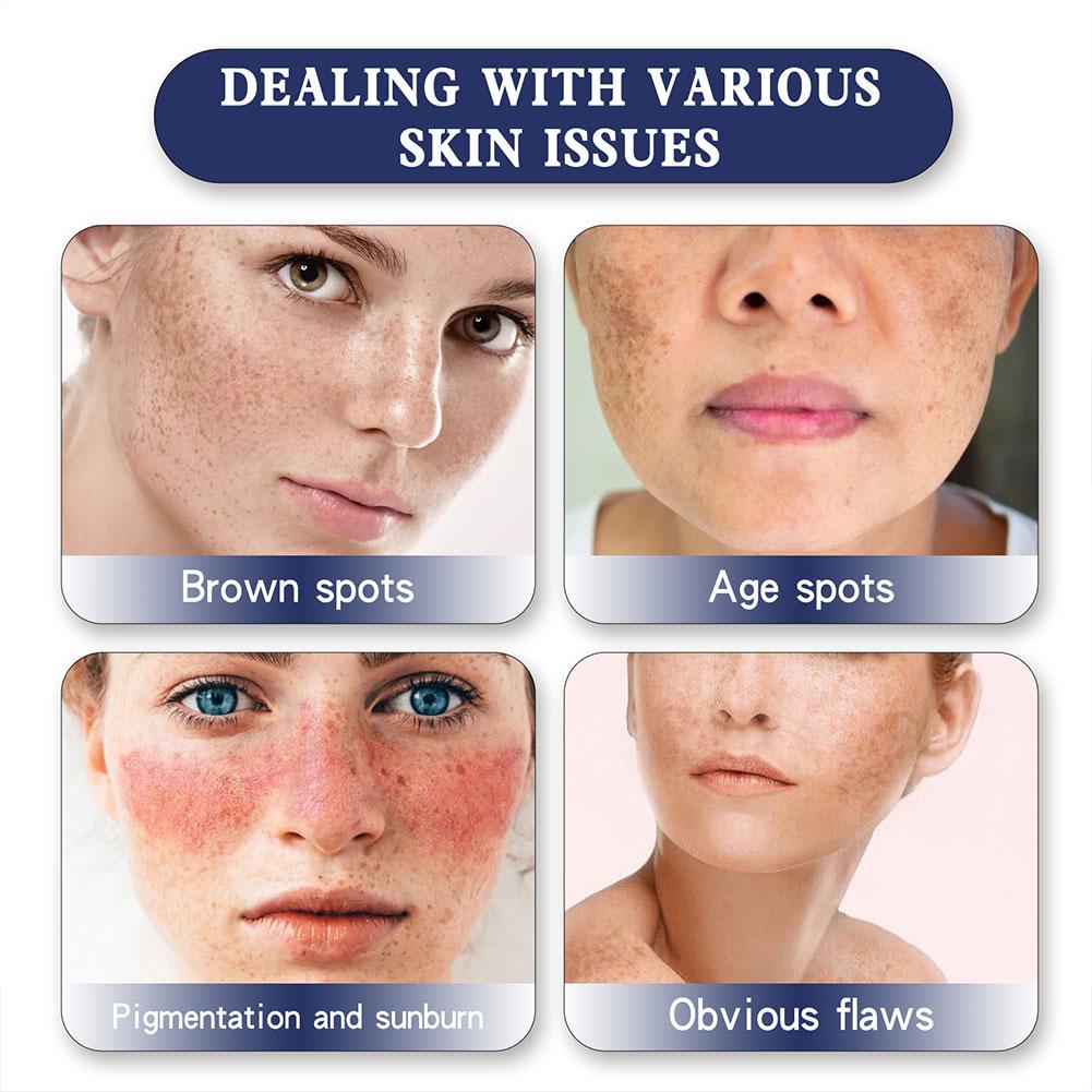 477Skin Genesis Spot Whitening Gream Fades Spot Brightens Moisturizes Skin Smoothes Relieves An R4M7