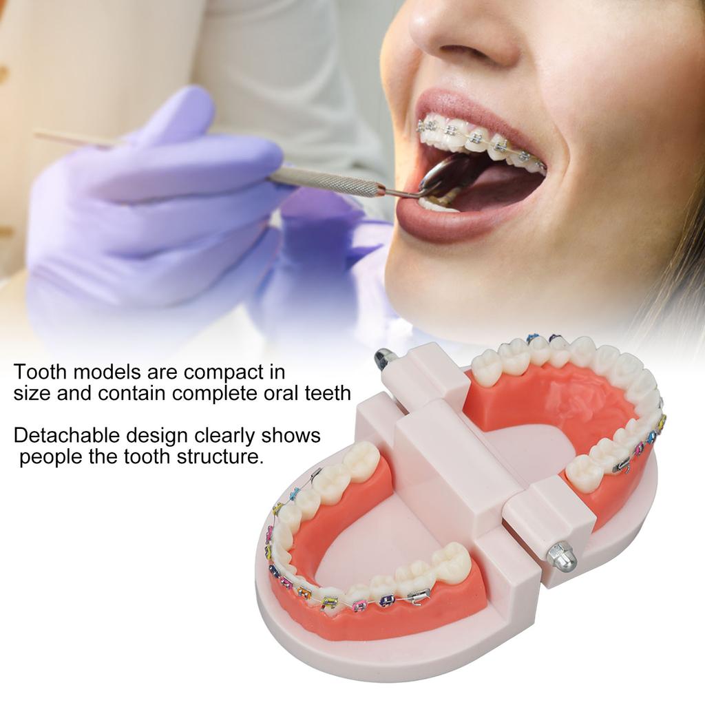 Dental Typodont Teeth Model with Orthodontic Metal Bracket for Dentist Teaching Research Dental Laboratory