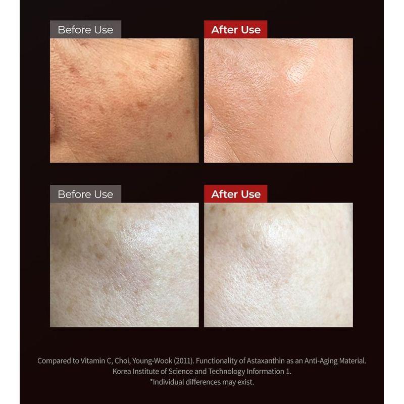 Dr.Melaxin - Astaxanthin Brightening Ampoule