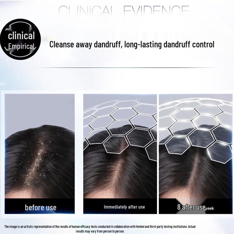 Schwarzkopf Anti-Dandruff Conditioning Shampoo