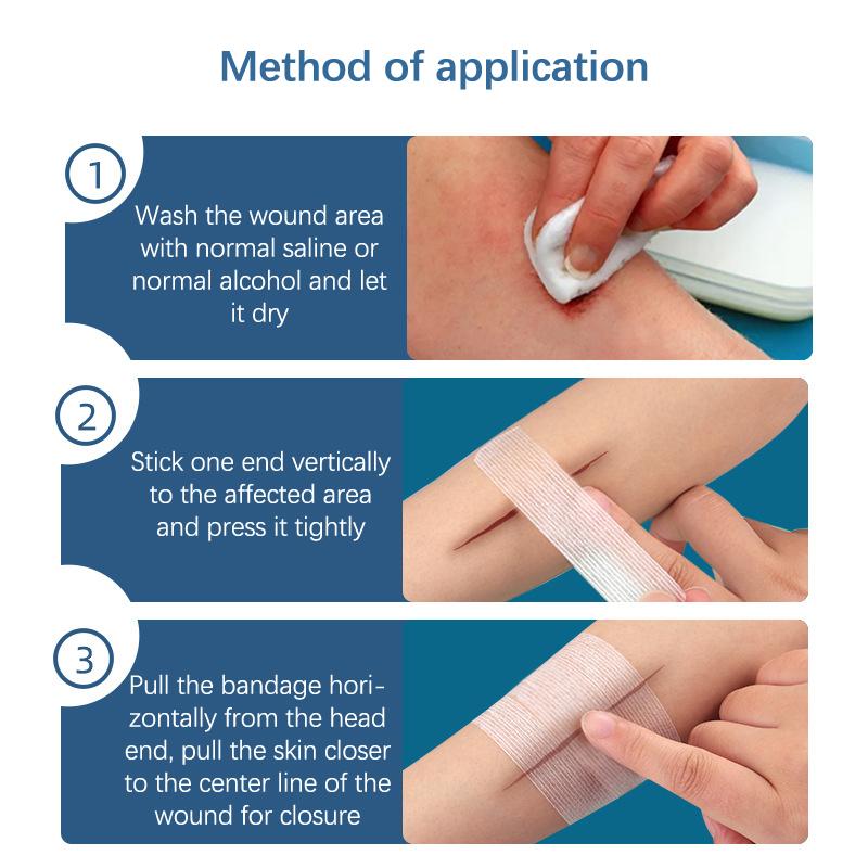 2/3/5 Strips 10cm Adhesive Sterile Medical Bandage Strips Wound Closure Tapes Skin Repair First Aid Surgical Breathable Tape