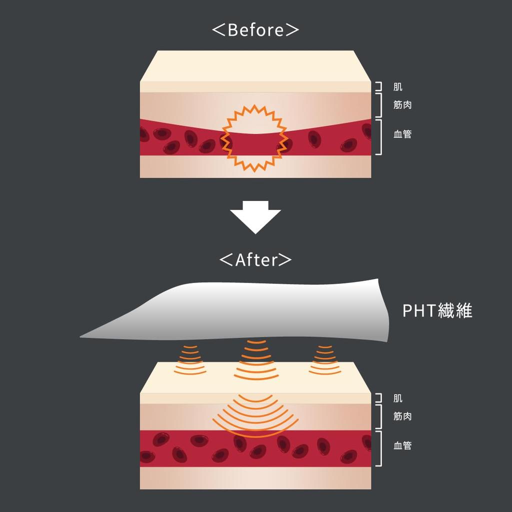 VENEX Recovery Wear and Ankle Accessories Leg Comfort Black L 6113 Knee, Calf, (03)