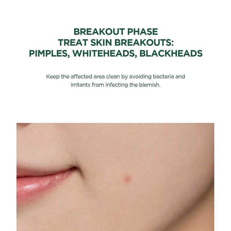 SKIN 1004 - Spot Cover Patch