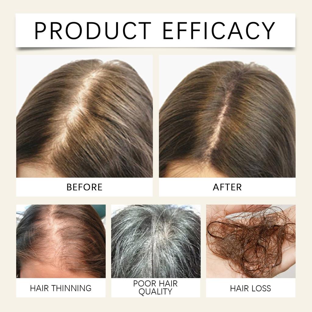 Hair Growth Care Capsules: Hair Growth Essence: Nourish The Scalp And Promote Hair Growth, Healthy Nutritional Care  Cream 30ml