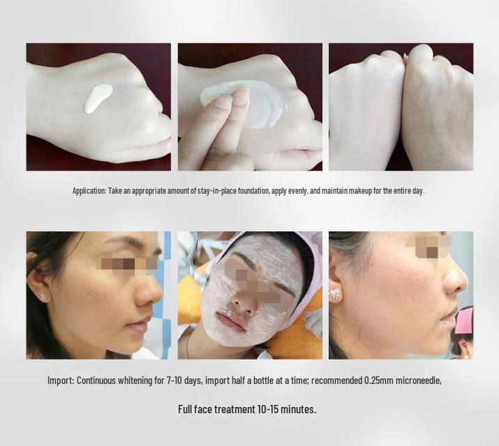 BB Glow Korean Semi-Permanent MTS Microneedle Foundation: Multi-Color Options