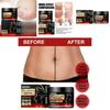 South Moon Scar Repair Cream Tightens Skin And Reduces Postpartum Scars