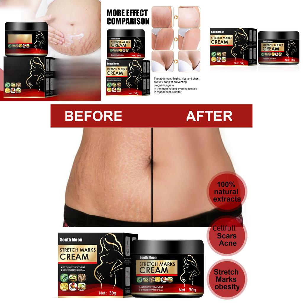 South Moon Scar Repair Cream Tightens Skin And Reduces Postpartum Scars