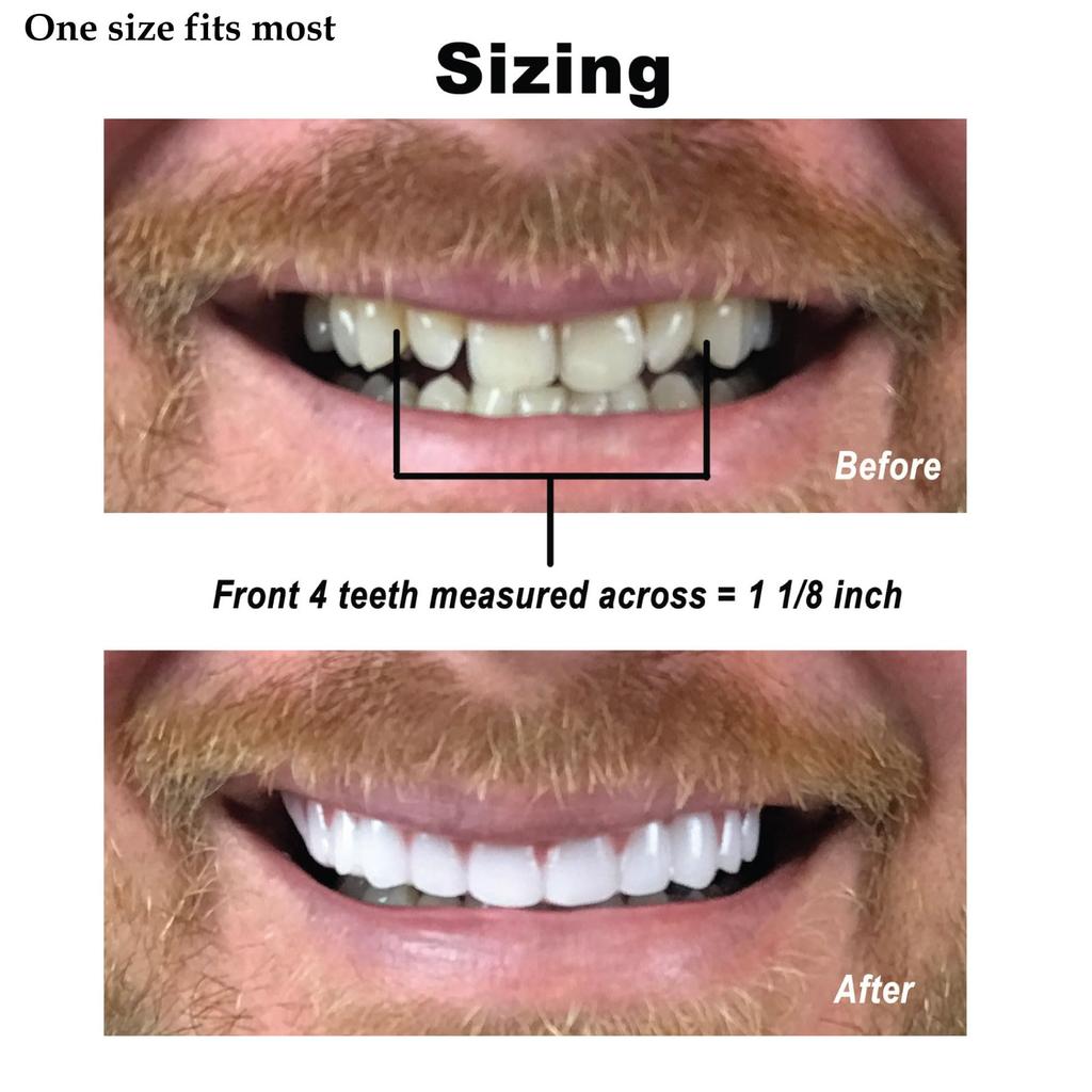Instant Smile Teeth Comfort Fit