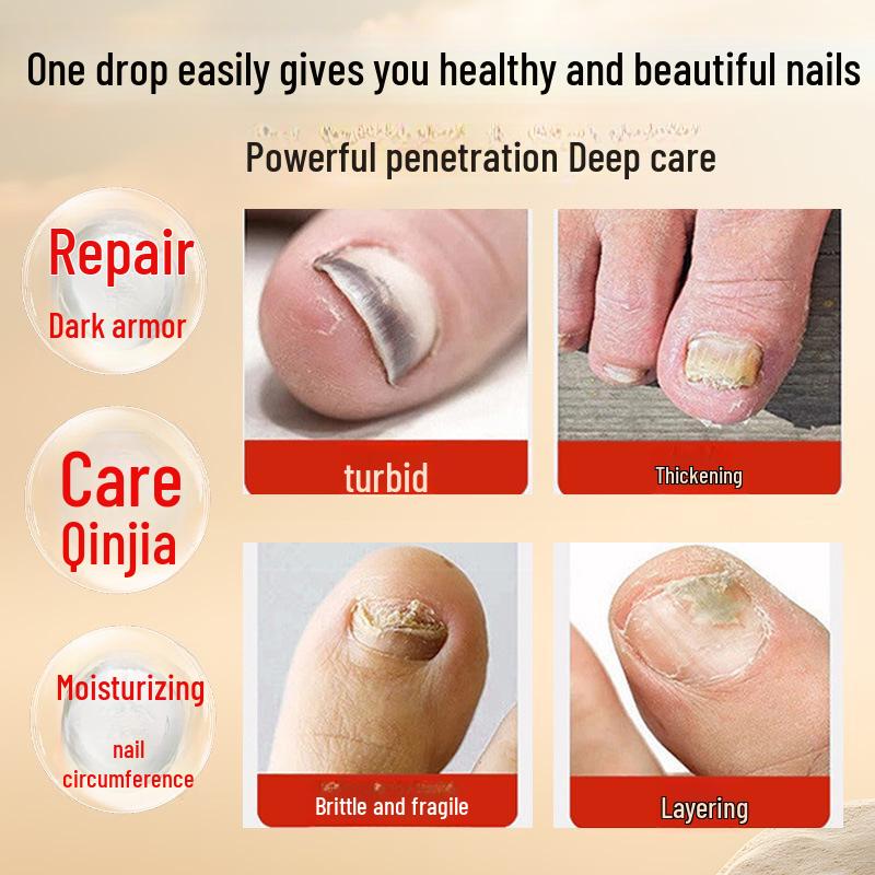 Hancui Liangfang Gray Nail Health Liquid - Onychomycosis Treatment Softener