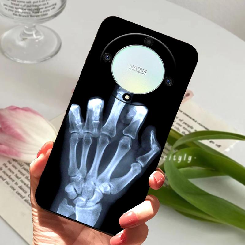 For Honor Magic6 Lite 5G Case Shockproof Soft TPU Silicone Phone Cover For Honor Magic 6 Lite 5G Capa Cartoon Magic6Lite 6 Lite