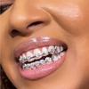 Hip-Hop 8 Teeth Real Gold Plating Braces Micro Inlay Love Diamond Cross-Border Halloween Jewelry