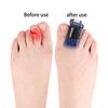Toe Splint Straightener For Hammer Toe Corrector Crooked Toe Claw Toe Stabilizer Support Brace Wrap Pain Relief Kids Adults