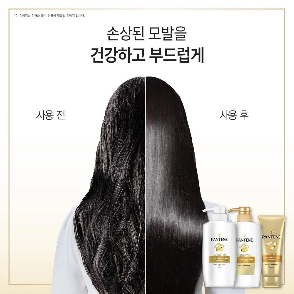 Pantene Severe Damage Care Treatment 220ml 3 Pieces