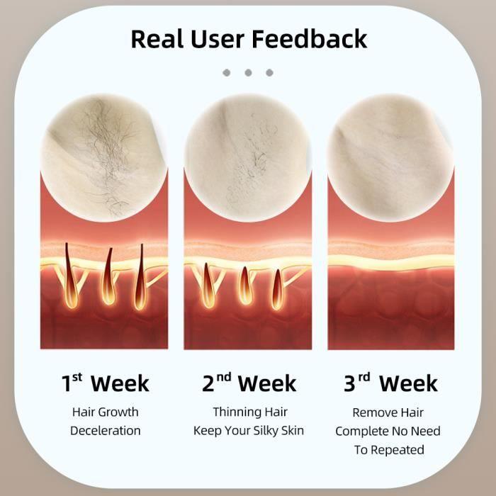 Ice Cooling Pulsed Light Epilator IPL Laser Epilator 500,000 Flashes Body Careless Hair Removal Care