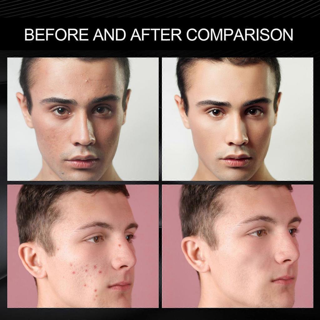 Omezený čas!!East Moon Pánský přírodní make-up krém, Lehký make-up korektor, Jizvy po akné, Vady pleti, Hydratační a zvlhčující, Krém pro línou krásu