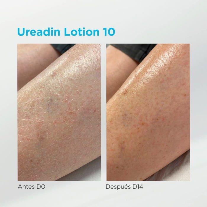 Lotion de Massage - ISDIN - UREADIN - Hydratant - Sans Odeur - Peau Grasse