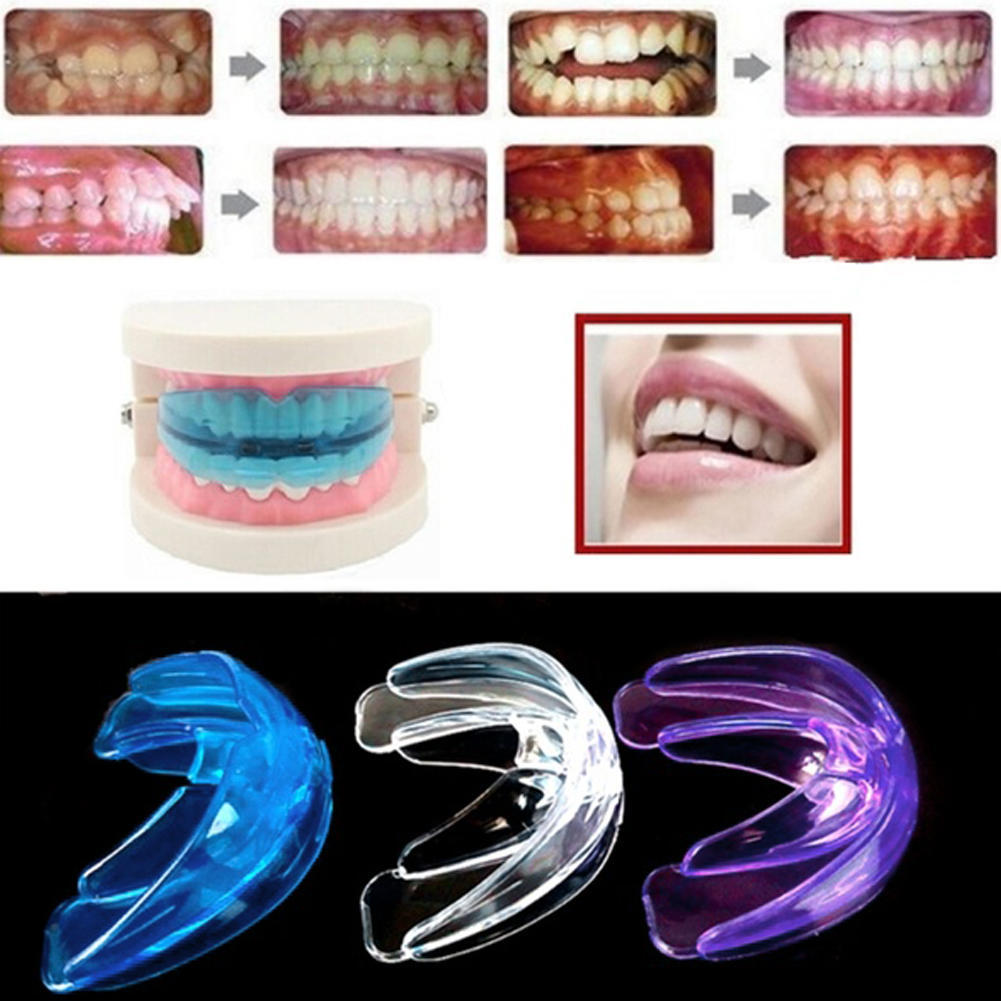 Pro E Contro Degli Apparecchi Dentali - Prima Monza - Foto 4