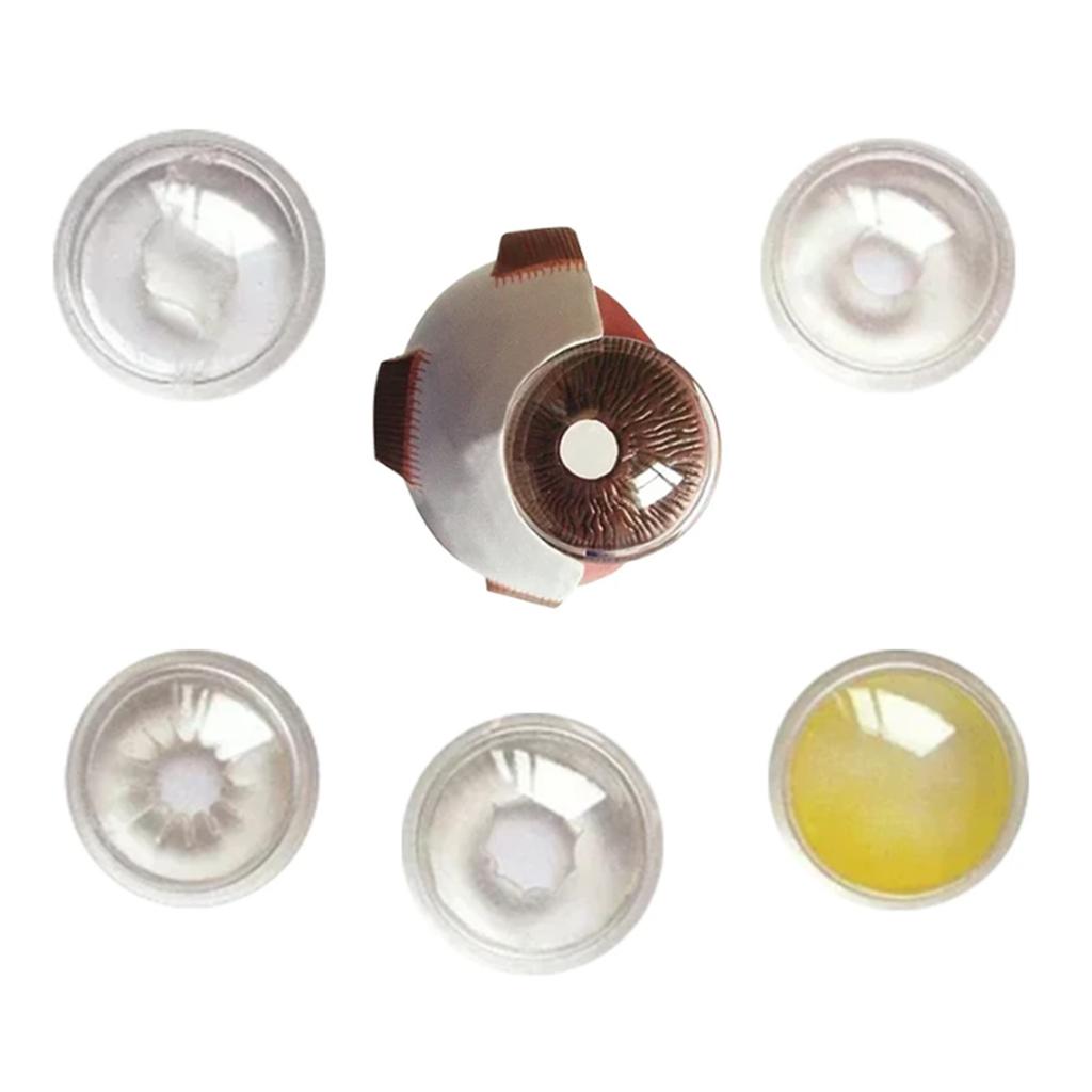 Human Eye Anatomy Model Anatomical Pathological Eyeball Model Teaching Tool Realistic Pathological Eyeball Anatomy Model