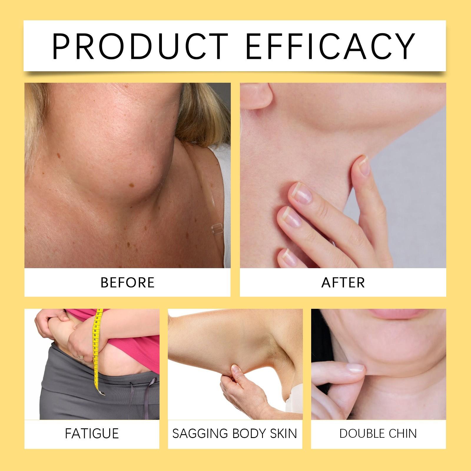 Пластырь для щитовидной железы — фото 6