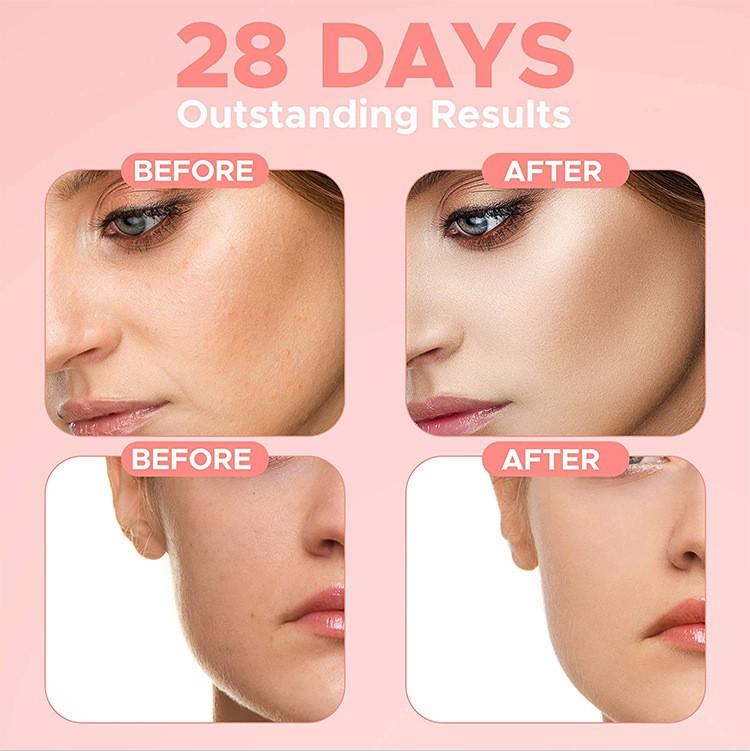 Facial  For Stain  Moisturizing And Firming Skin  C Facial  Containing VitaC    Hyaluronic Acd  -aging 30ml