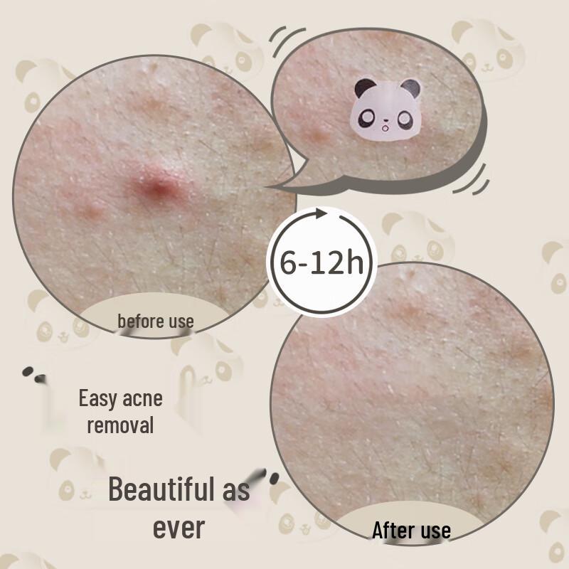 AUSLKA Beauty Panda Acne Patches