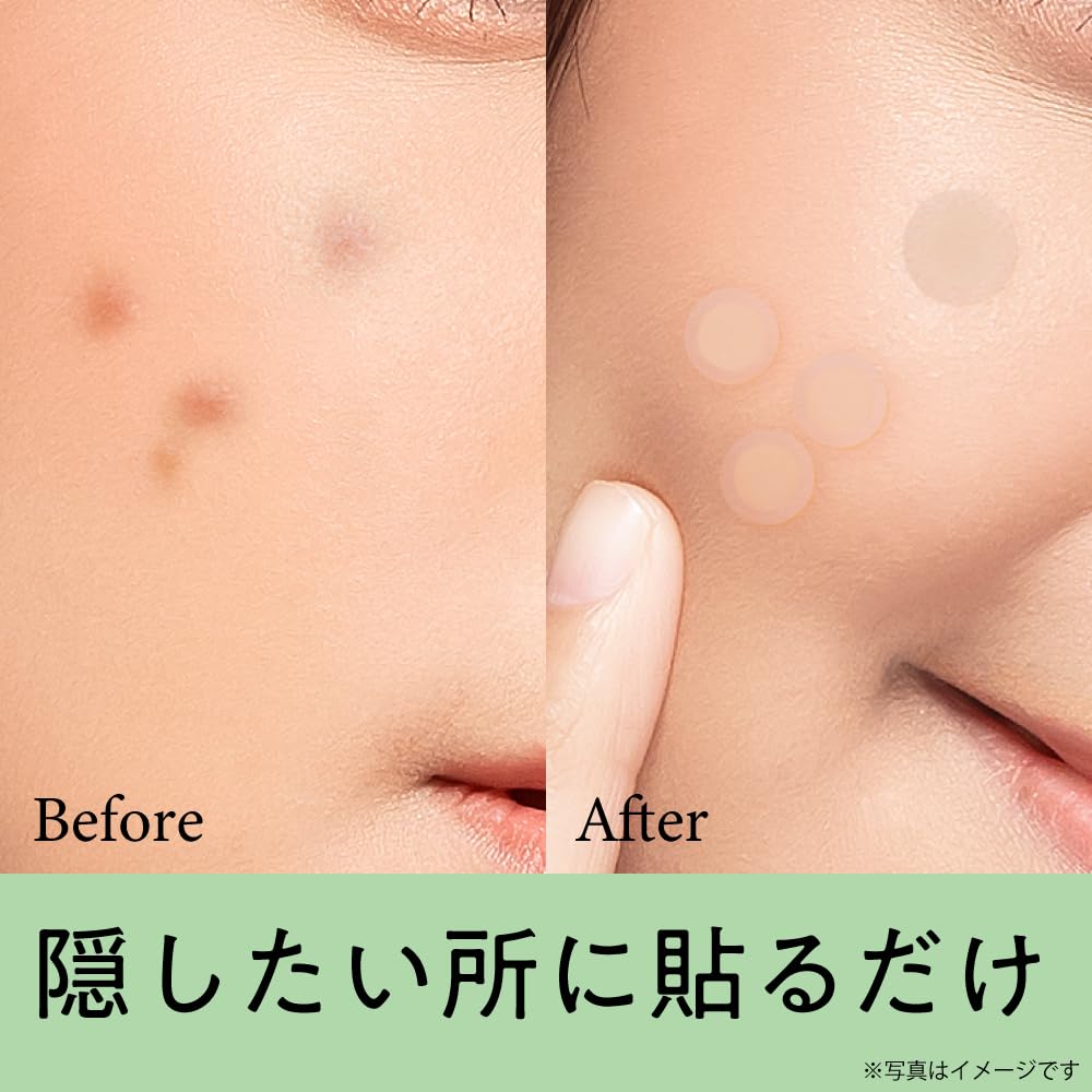 OK CICA Clear Hydrocolloid Spot Concealer Patches with Centella Asiatica Extract for Acne with G9SKIN Patches, 36-Pack, Patches, Scars, Co-Developed