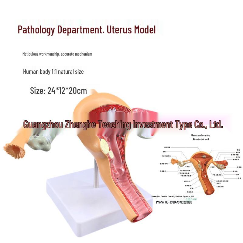 Female Reproductive System Anatomy Model for Gynecology Education