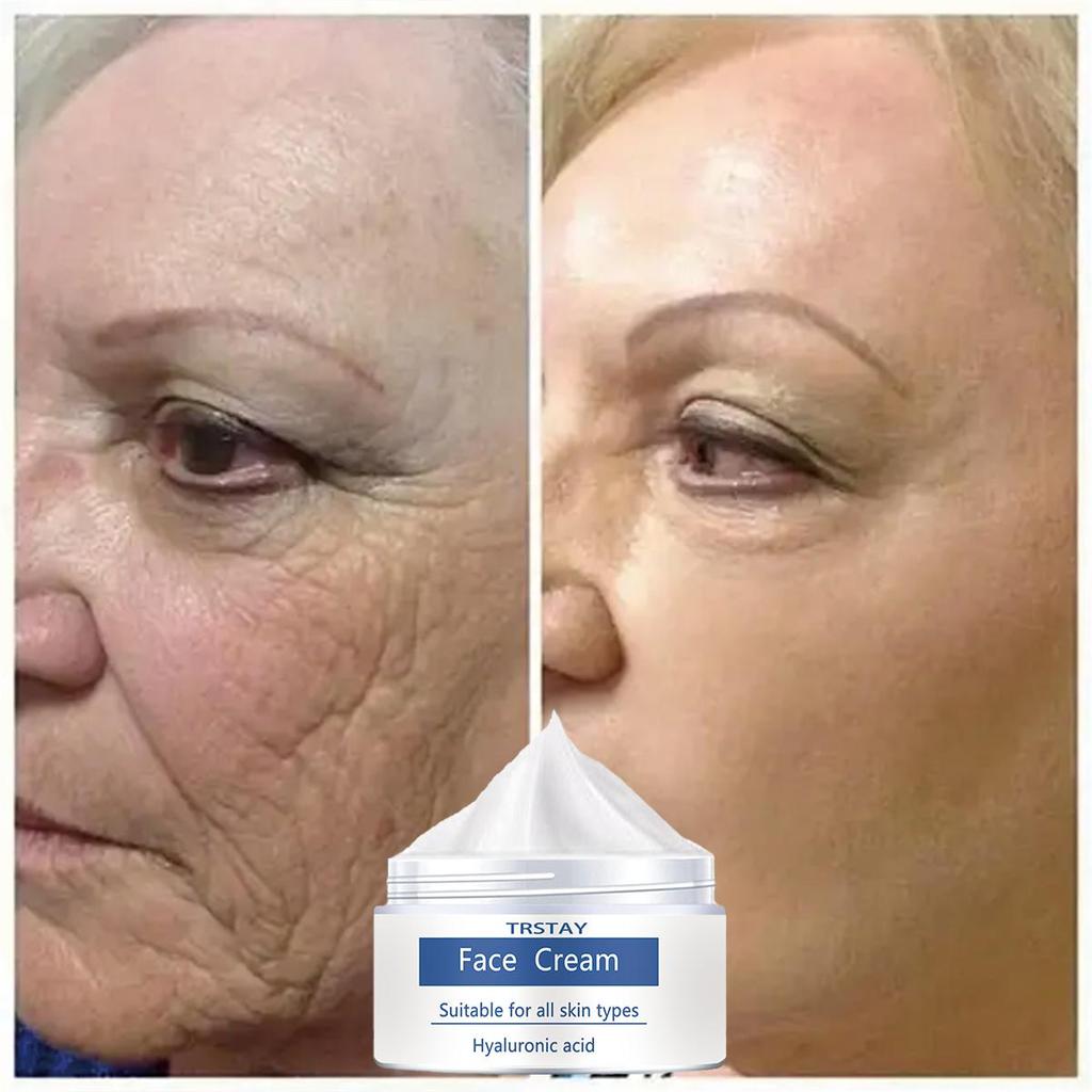 Anti-aging Wrinkle Moisturizing Cream, Gentle and Non-irritating, Smooths Wrinkles and Fades Fine Lines