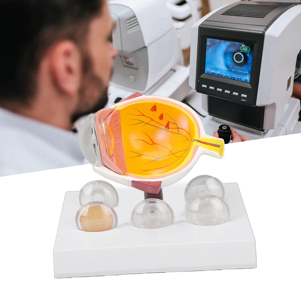 Enlarged Human Eye Anatomical Model Accurate Shows Optic Nerves Cornea Iris Lens Medical Eyeball Model