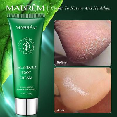 Foot Treatment Cream Whitening Anti-cracking Moisturizing Foot Care Exfoliating Scrub Anti-dry Calendula Olive Repair