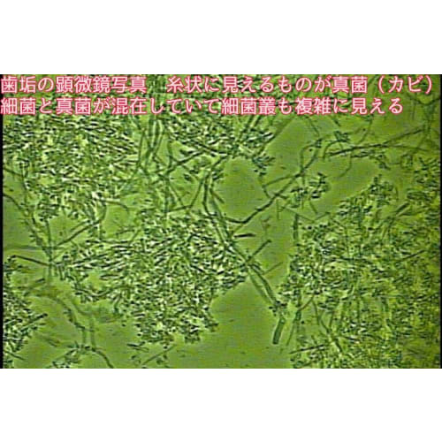 Plant-based Toothpaste Focuses On Fungi Such As Candida In the Mouth. Contains Seven Plant-based Ingredients That Fight Fungi. Refreshes the Mouth. No